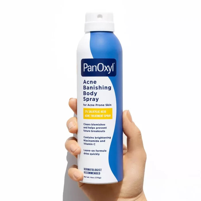 Acne Banishing Body Spray 2% Salicylic Acid - Free Shipping – lawahgni